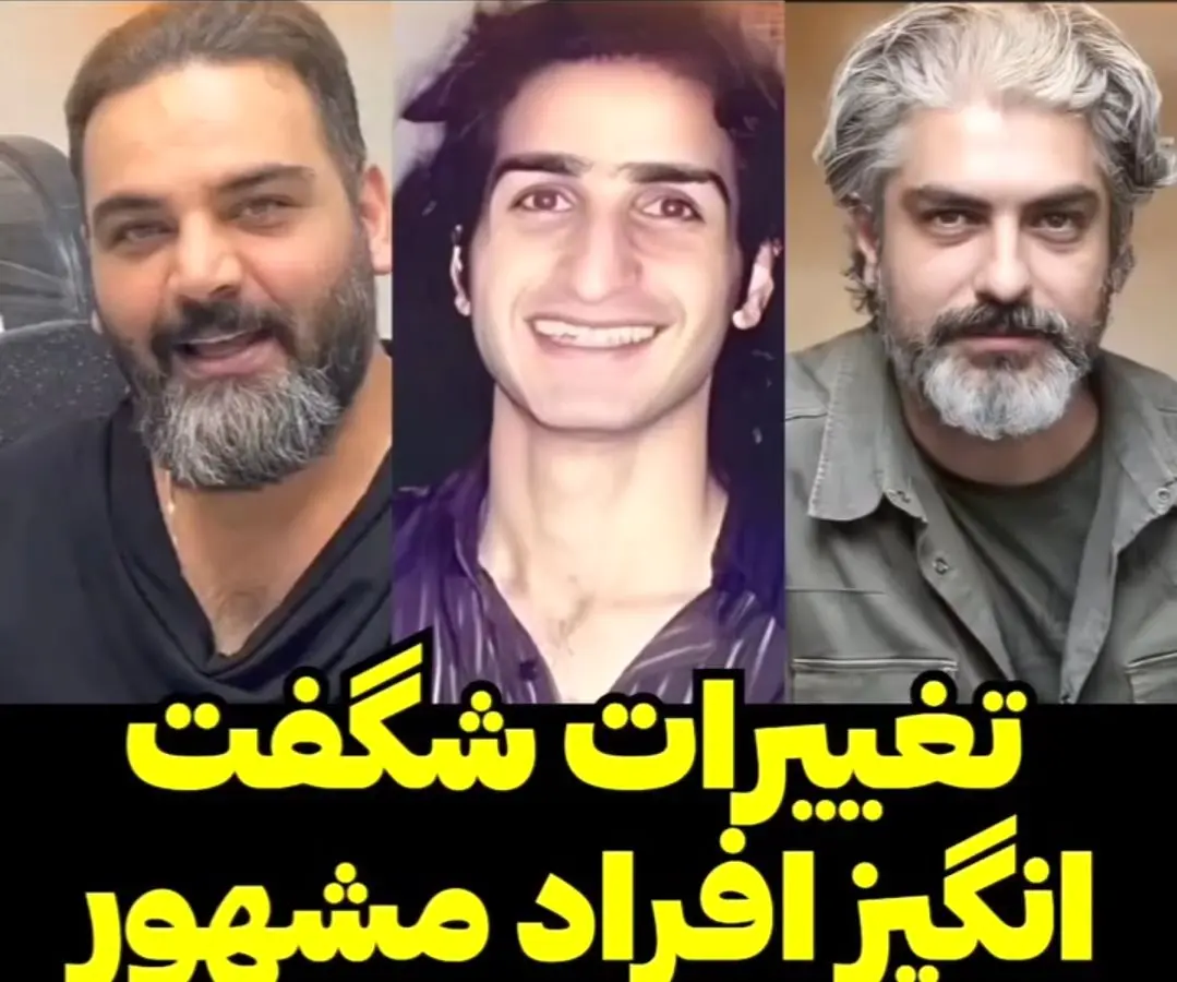 تغییر شگفت‌انگیز چهره افراد مشهور قبل و بعد از رسیدن به شهرت 