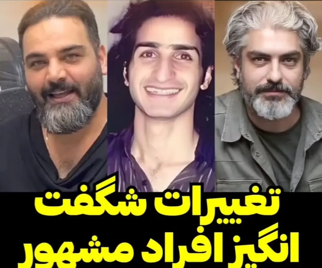 تغییر شگفت‌انگیز چهره افراد مشهور قبل و بعد از رسیدن به شهرت 
