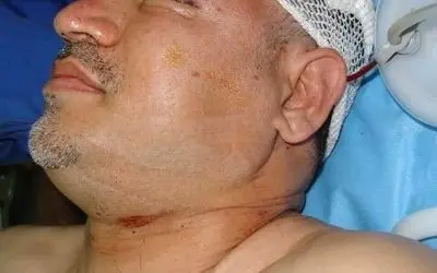 علی دایی در بیمارستان پس از تصادف؛ حضور عادل فردوسی‌پور و احمدرضا عابدزاده در کنار اسطوره فوتبال ایران