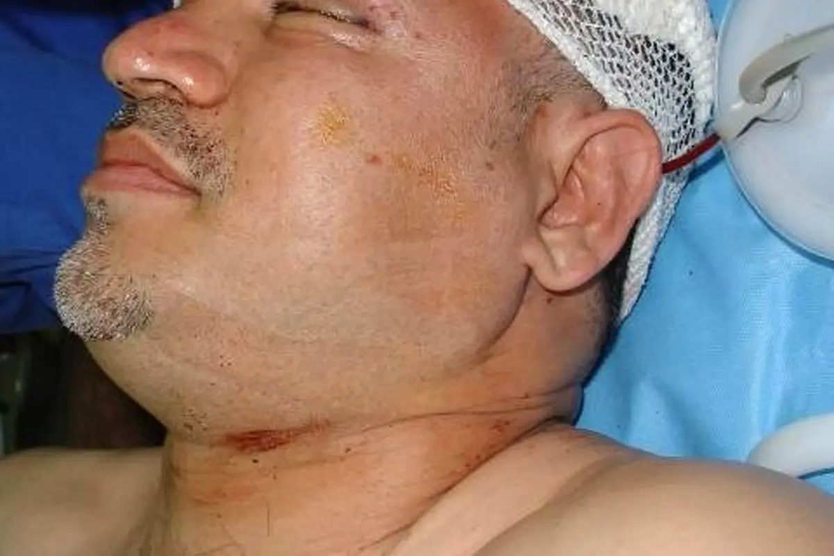 علی دایی در بیمارستان پس از تصادف؛ حضور عادل فردوسیپور و احمدرضا عابدزاده در کنار اسطوره فوتبال ایران