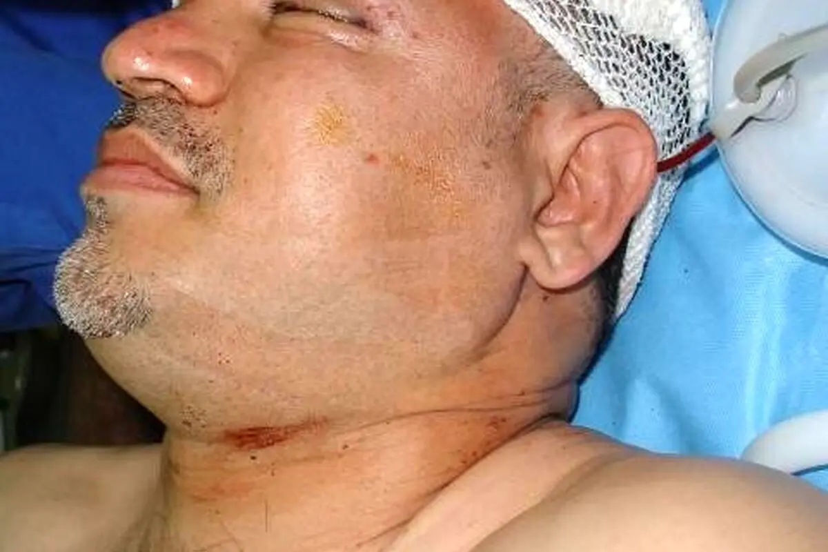 علی دایی در بیمارستان پس از تصادف؛ حضور عادل فردوسی‌پور و احمدرضا عابدزاده در کنار اسطوره فوتبال ایران