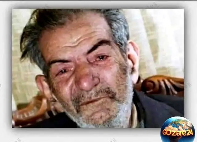 تصویر واقعی معشوقه استاد شهریار بر روی تخت بیمارستان؛ عشقی که هرگز طعم وصال نیافت