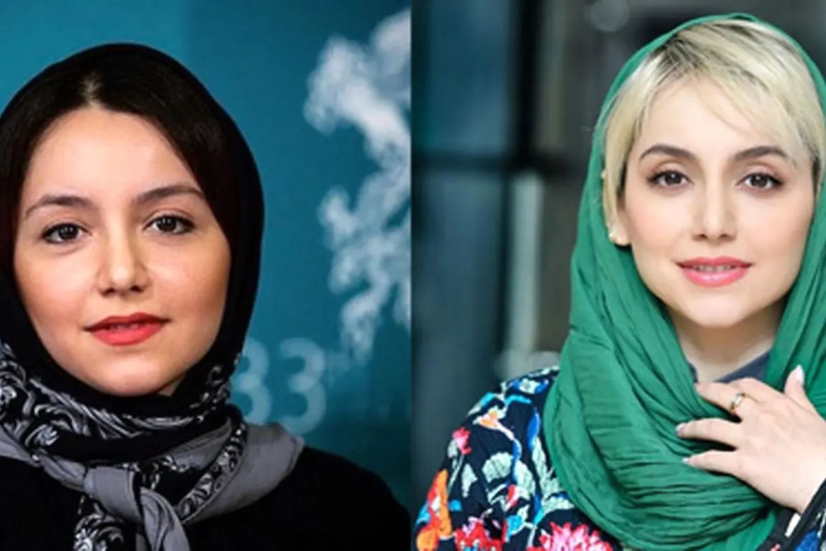 آیا نازنین بیاتی جراحی زیبایی انجام داده است؟ بررسی تغییرات ظاهری و رازهای زیبایی او