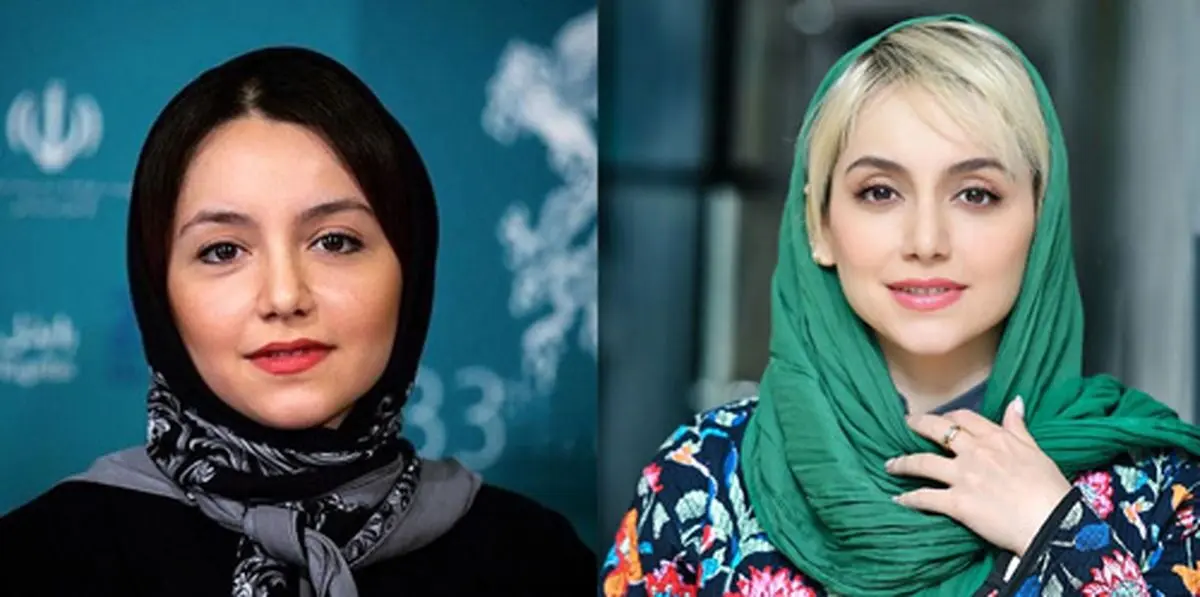 آیا نازنین بیاتی جراحی زیبایی انجام داده است؟ بررسی تغییرات ظاهری و رازهای زیبایی او