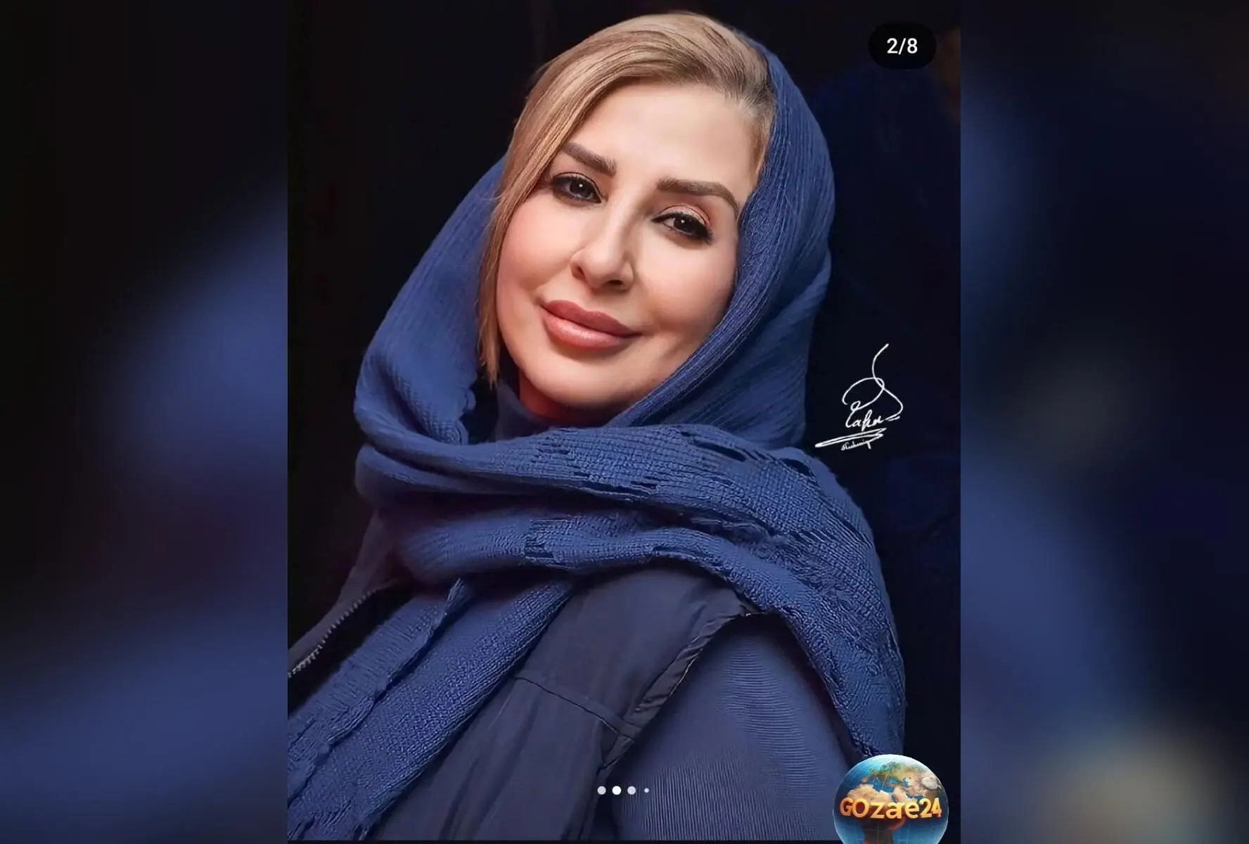 مرجانه گلچین با تغییر چهره حیرت‌انگیز و ژست مدلینگ در صفحه اینستاگرام خود+ عکس جدید