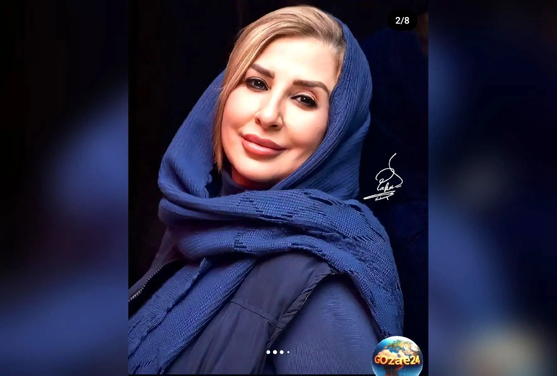 مرجانه گلچین با تغییر چهره حیرت‌انگیز و ژست مدلینگ در صفحه اینستاگرام خود+ عکس جدید