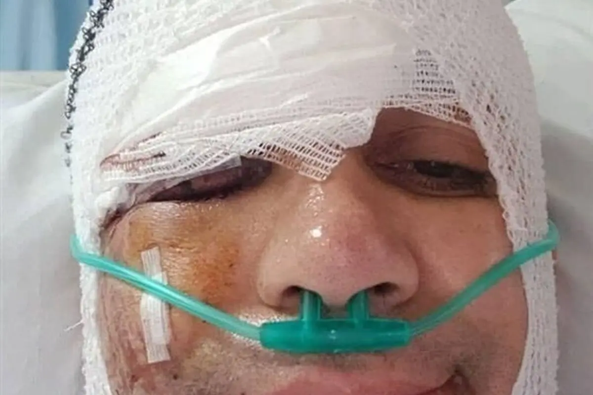 تصاویر و داستان‌های جالب از بازیگران و ورزشکارانی که از تصادف جان سالم به در بردند