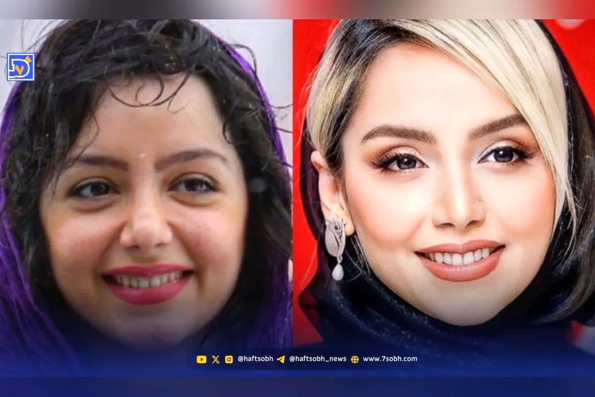 تغییرات چهره نازنین بیاتی از گذشته تا امروز؛ رازهای زیبایی طبیعی و اقدامات زیبایی او