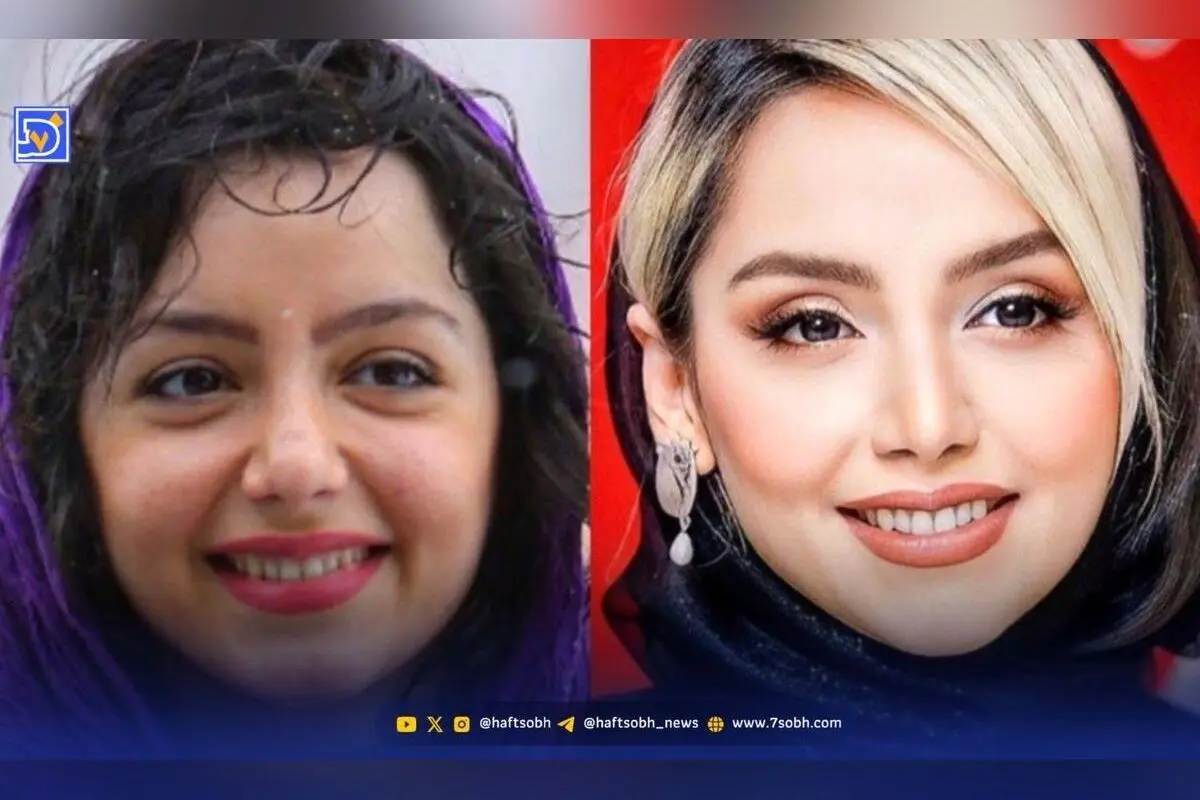 تغییرات چهره نازنین بیاتی از گذشته تا امروز؛ رازهای زیبایی طبیعی و اقدامات زیبایی او
