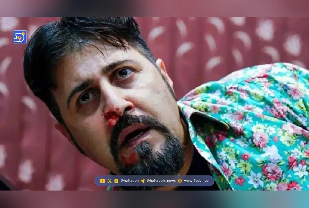 طراحی داخلی لوکس هومن حاجی عبداللهی | مبلمان مدرن، اکسسوری‌های گران‌قیمت و چیدمان زیبا