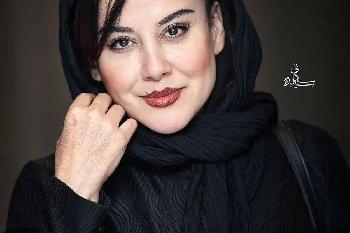 پزشک زیبایی آشا محرابی لو رفت: راز هنرمندانه و حاذق او در عرصه زیبایی فاش شد!