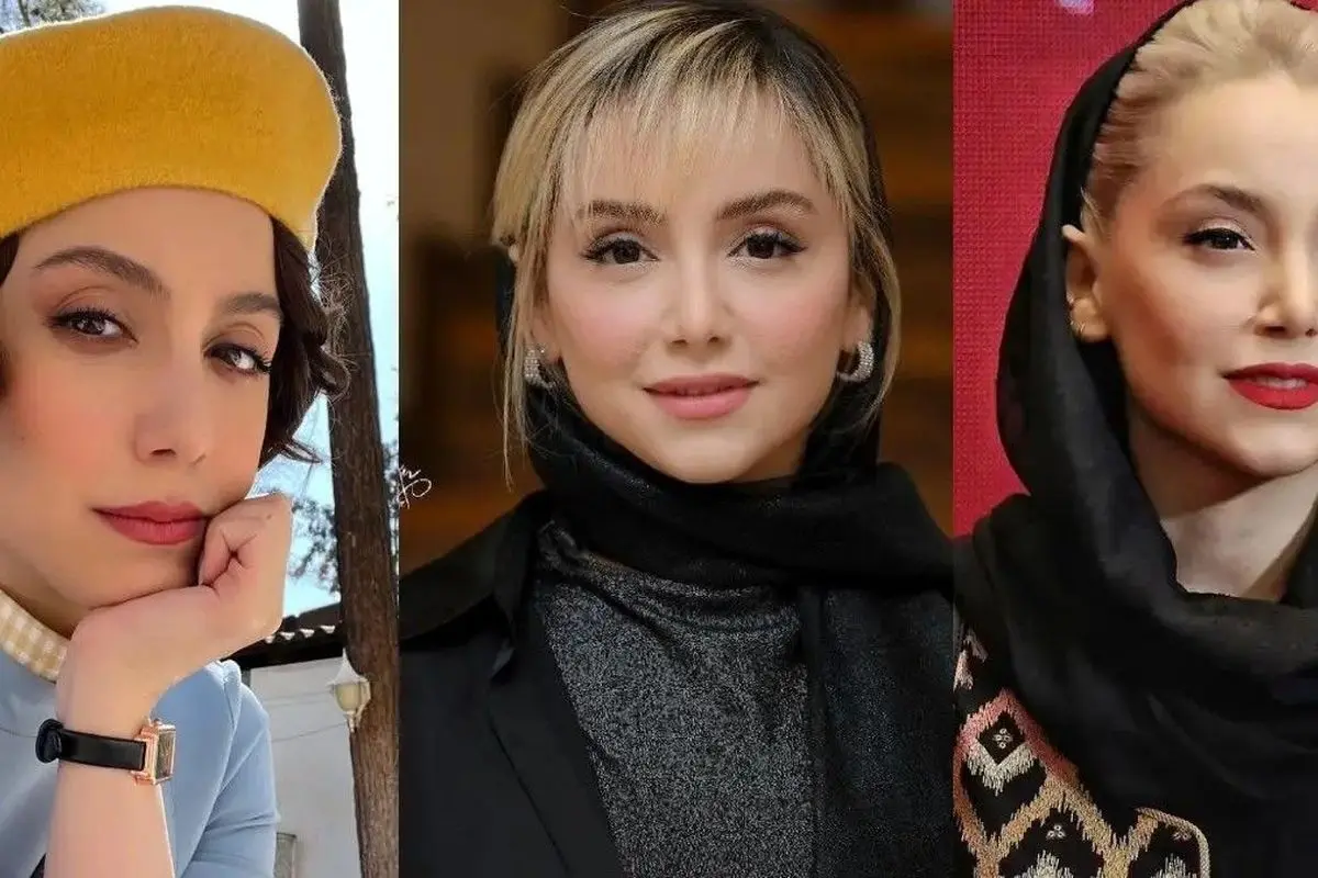 تغییر چهره عجیب نازنین بیاتی پس از عمل جراحی؛ تصاویر قبل و بعد شوکهکننده