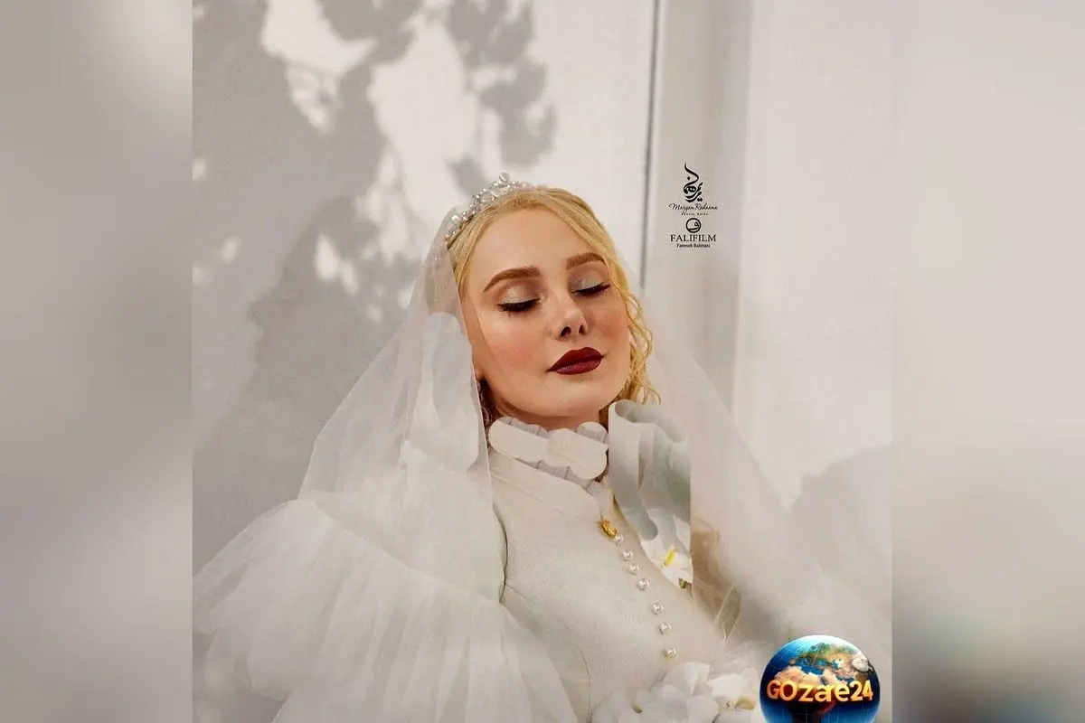 آرام جعفری از عمل بینی و کاشت ابرو می‌گوید: رازهای زیبایی تازه‌عروس در گفت‌وگو و ویدیو