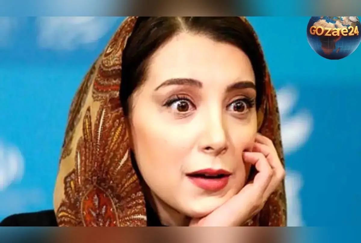 حادثه تلخ سحر جعفری جوزانی؛ خطای پزشکی منجر به فلج صورت و هشدار درباره انتخاب پزشک