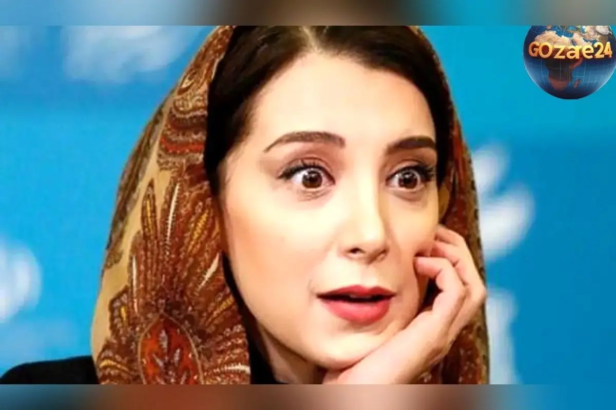 حادثه تلخ سحر جعفری جوزانی؛ خطای پزشکی منجر به فلج صورت و هشدار درباره انتخاب پزشک