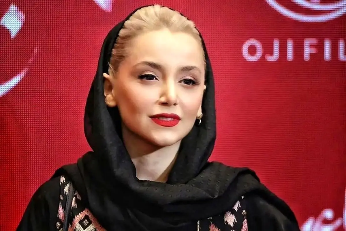 تحول چهره نازنین بیاتی و شقایق فراهانی؛ تصاویر قبل و بعد تغییرات جذاب هنرمندان محبوب ایرانی