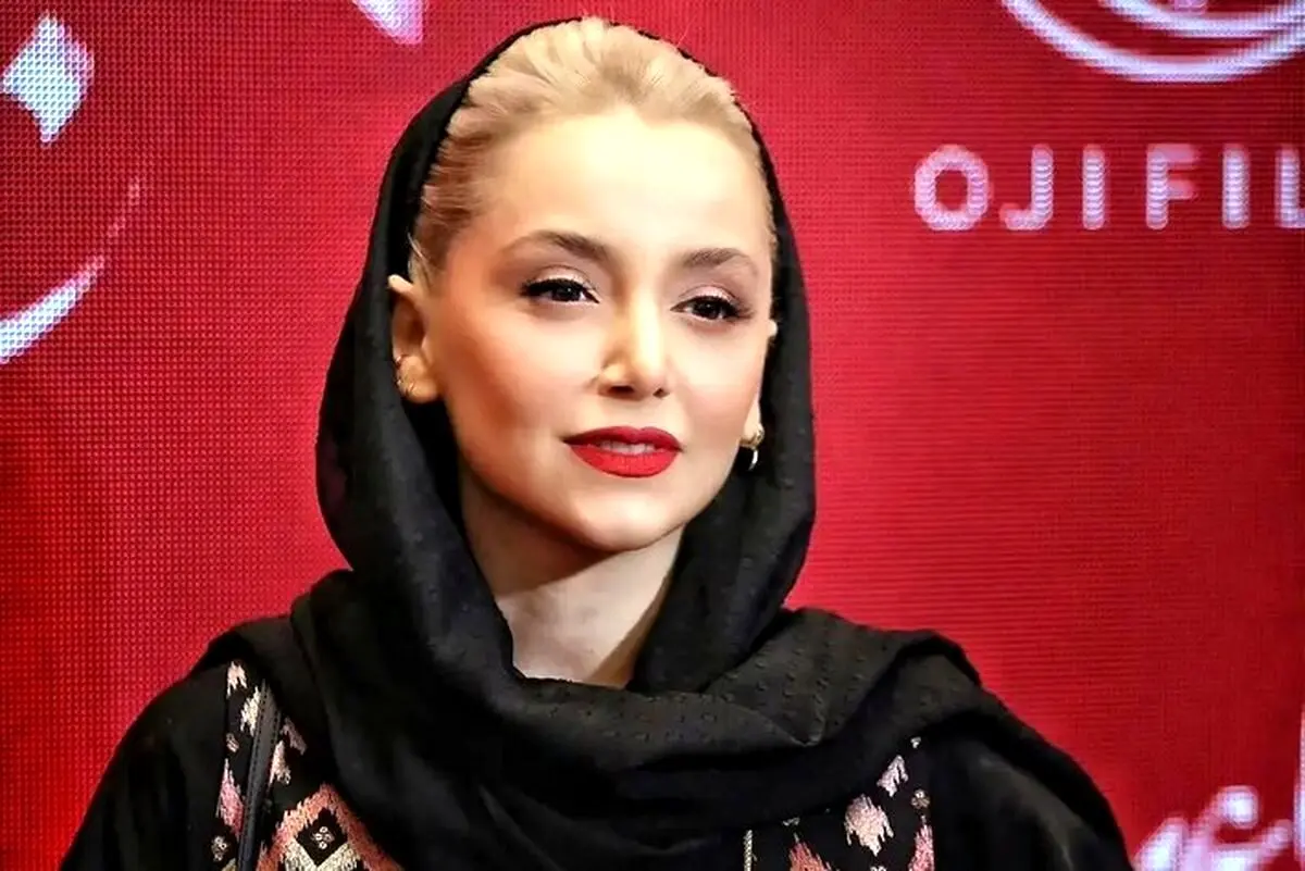 تحول چهره نازنین بیاتی و شقایق فراهانی؛ تصاویر قبل و بعد تغییرات جذاب هنرمندان محبوب ایرانی
