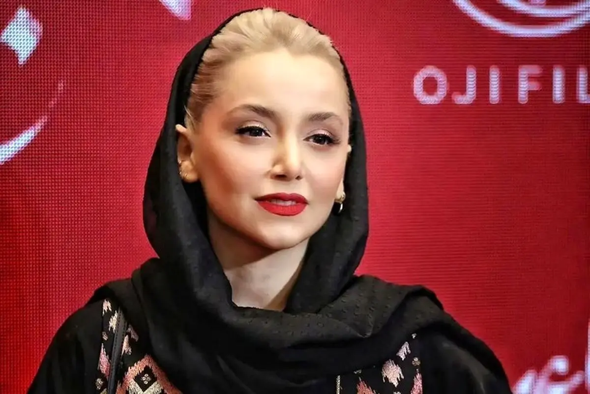 تحول چهره نازنین بیاتی و شقایق فراهانی؛ تصاویر قبل و بعد تغییرات جذاب هنرمندان محبوب ایرانی