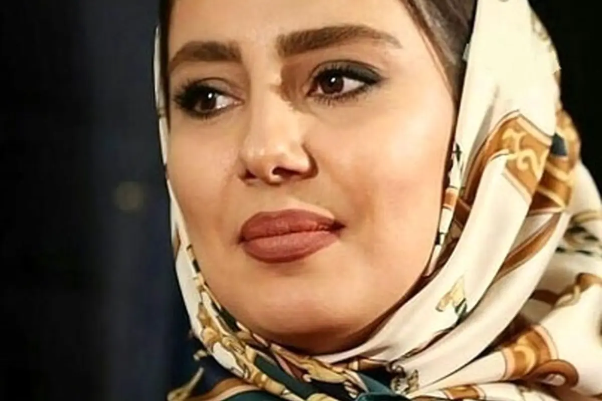 استایل تابستانی لوکس و شیک شیدا یوسفی با کلاه ساحلی و پیراهن زرد لیمویی | مد روز و جذاب بازیگر محبوب