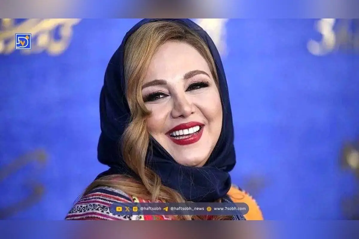 تصاویر قبل و بعد از عمل بینی بهنوش بختیاری؛ نگاهی متفاوت به زیبایی طبیعی و تغییرات چهره ستاره سینما