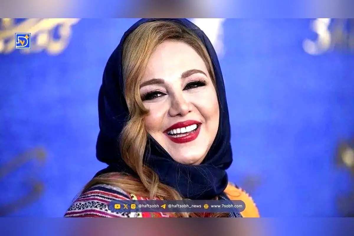 تصاویر قبل و بعد از عمل بینی بهنوش بختیاری؛ نگاهی متفاوت به زیبایی طبیعی و تغییرات چهره ستاره سینما