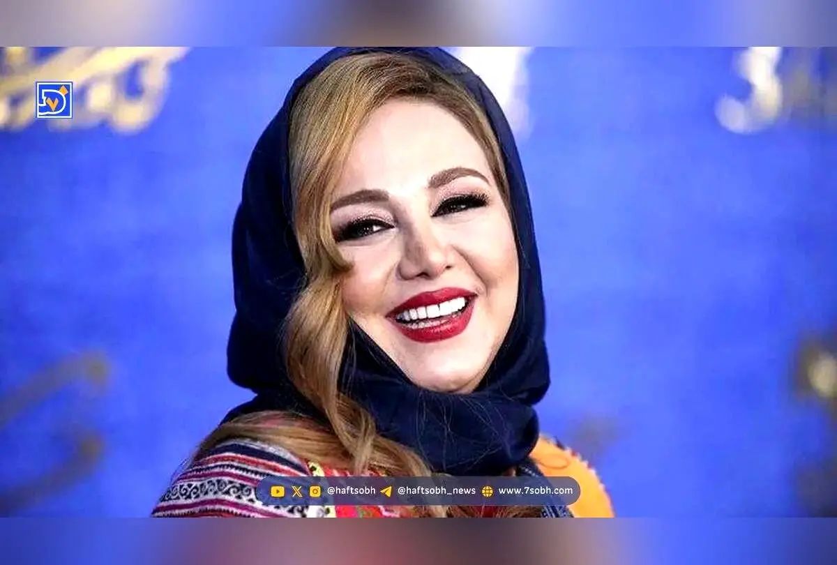 تصاویر قبل و بعد از عمل بینی بهنوش بختیاری؛ نگاهی متفاوت به زیبایی طبیعی و تغییرات چهره ستاره سینما