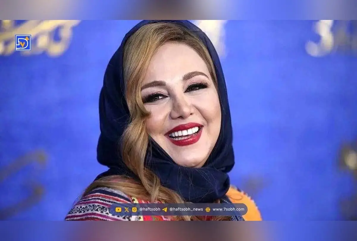 تصاویر قبل و بعد از عمل بینی بهنوش بختیاری؛ نگاهی متفاوت به زیبایی طبیعی و تغییرات چهره ستاره سینما