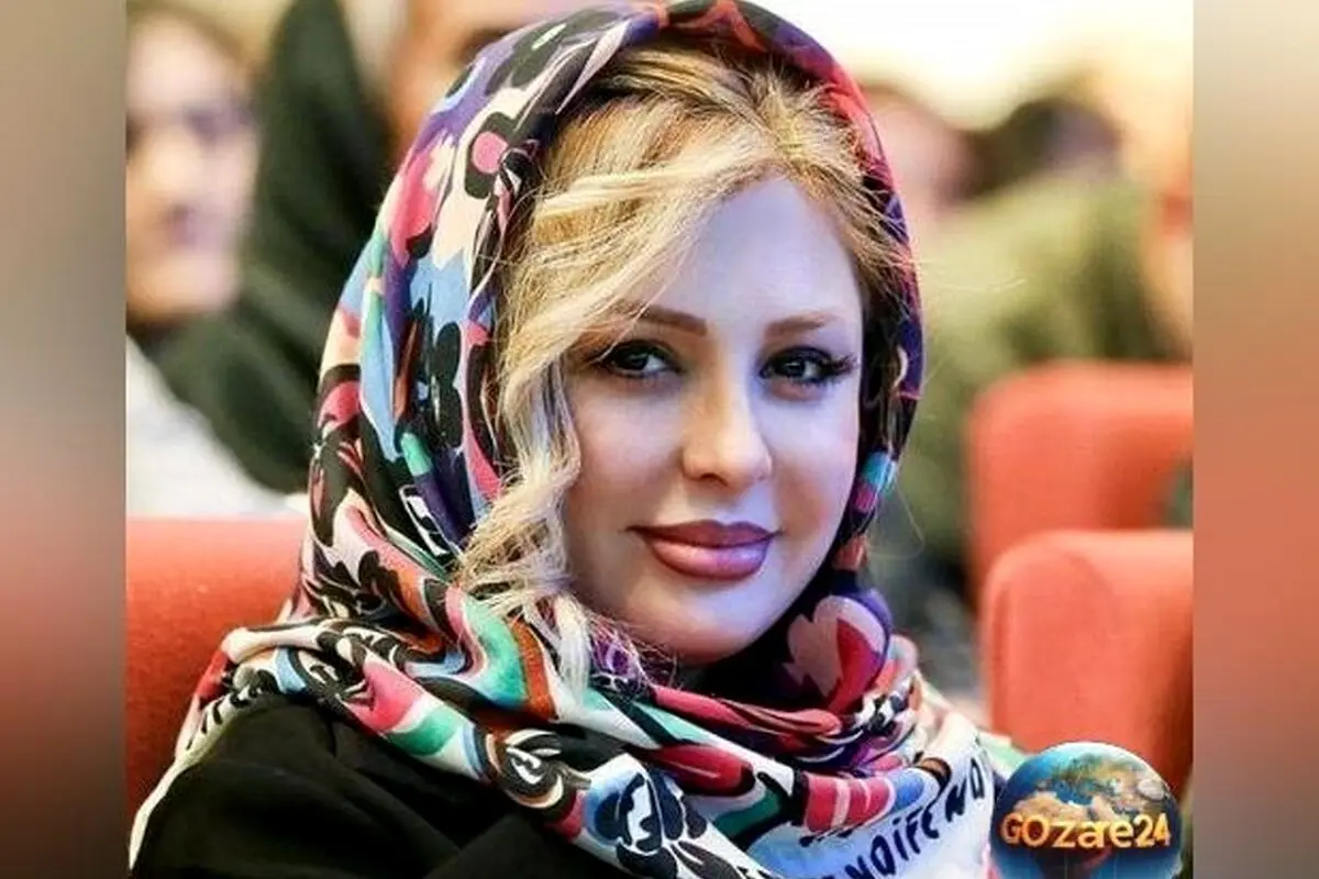 نیوشا ضیغمی از عمل سنگین بینی و مشکل تنفسی‌اش می‌گوید: پیوند غضروف و تجربه‌ای که تغییر کرد