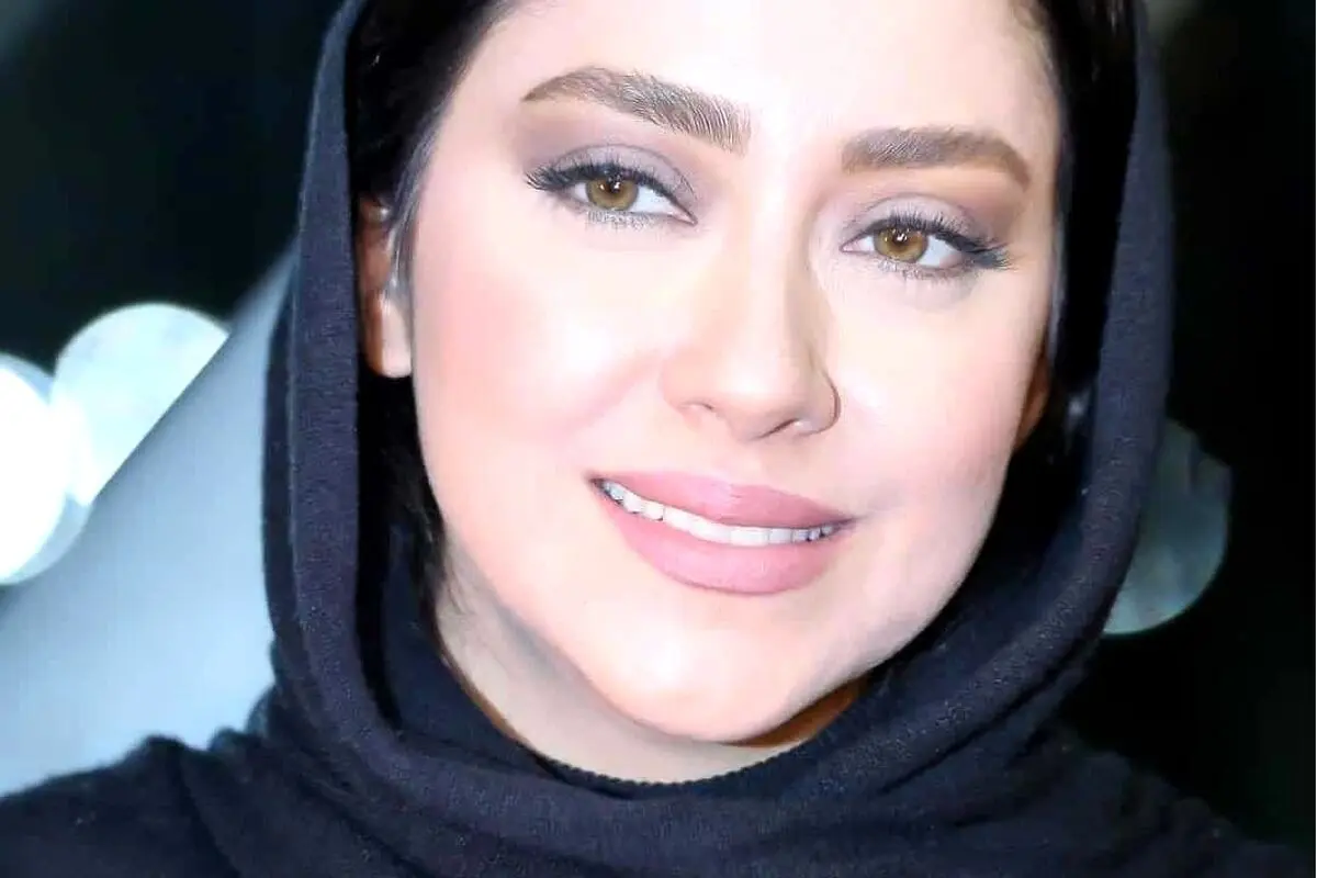استایل خاص و جذاب بهاره کیان افشار در بهار ۱۴۰۳؛ نگاهی به ظاهر و دندان‌های کامپوزیت این ستاره محبوب
