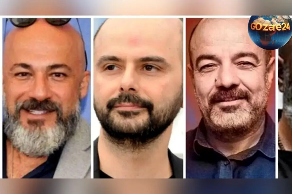 تصاویر قبل و بعد کچلی بازیگران ایرانی دهه 70 و 80؛ تغییرات ظاهری ستارگان سینما و تلویزیون
