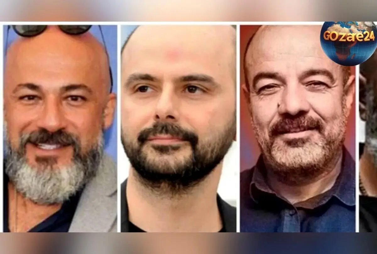تصاویر قبل و بعد کچلی بازیگران ایرانی دهه 70 و 80؛ تغییرات ظاهری ستارگان سینما و تلویزیون